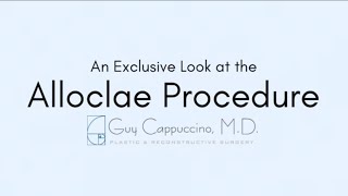 Alloclae Procedure: Breast Augmentation