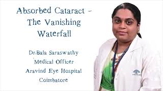 Absorbed Cataract - The Vanishing Waterfall by Dr Bala Saraswathy