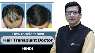 Best Hair Transplant Doctor in Indore | best Hair Transplant Clinic in Indore, Bhopal | Dr Anil Garg