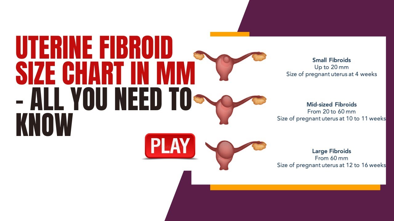 Uterine Fibroid Measurement Chart