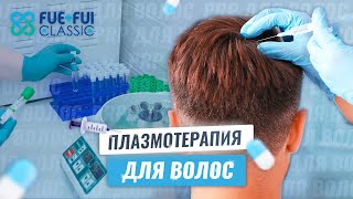 Как выполняется настоящая плазмотерапия волос?