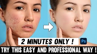 Skin Retouching In 2 Minutes | Photoshop Tutorial | Tamil | Pimple removing | Trending Photography