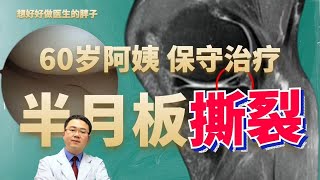 60岁阿姨膝盖疼痛，核磁明确半月板撕裂，医生为啥选择保守治疗？