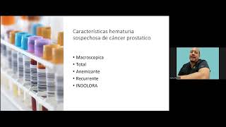 Hematuria, cuando sospechar cáncer de próstata