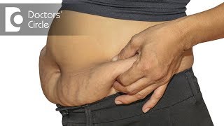 How to prevent sagging of skin after weight loss? - Dr. Nanda Rajaneesh