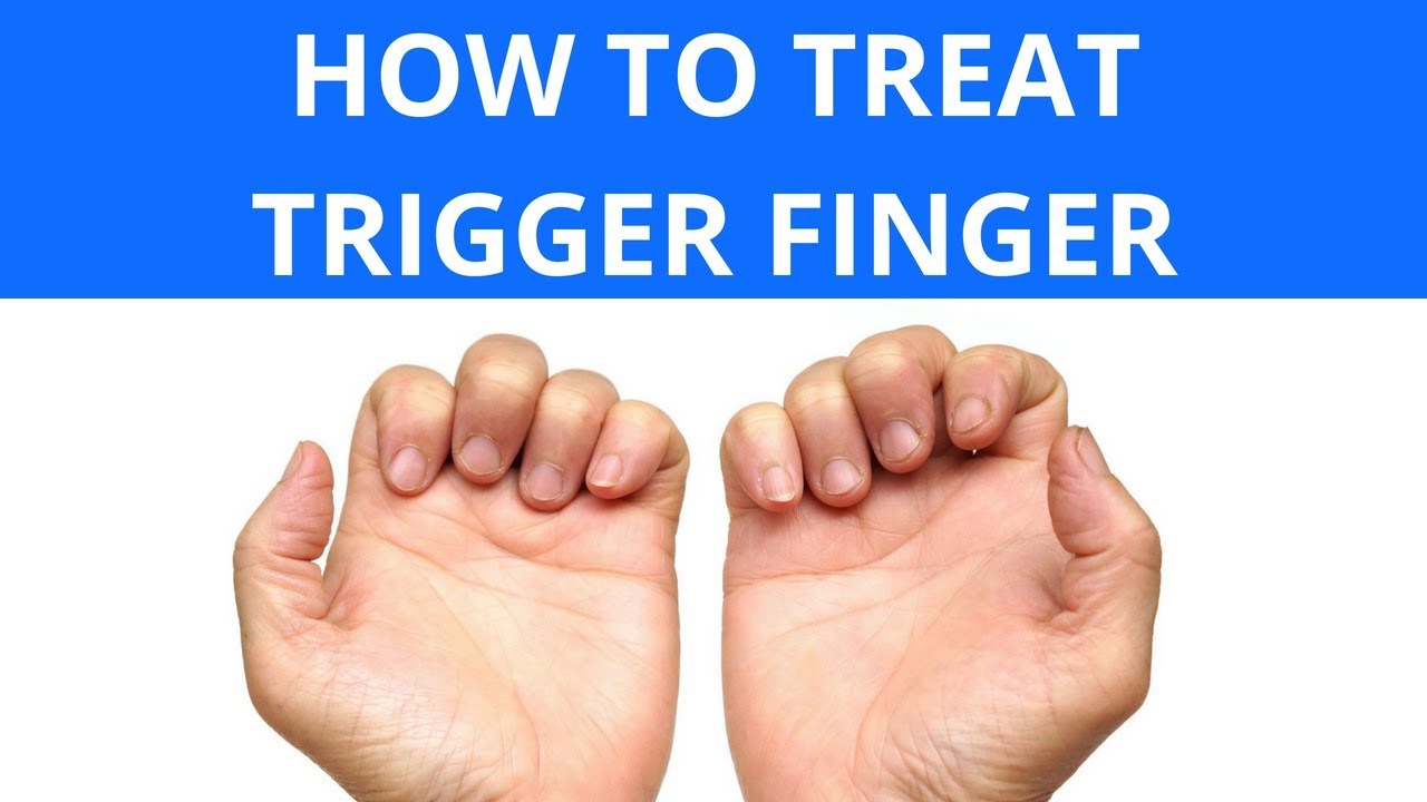 How To Treat Trigger Finger - YouTube