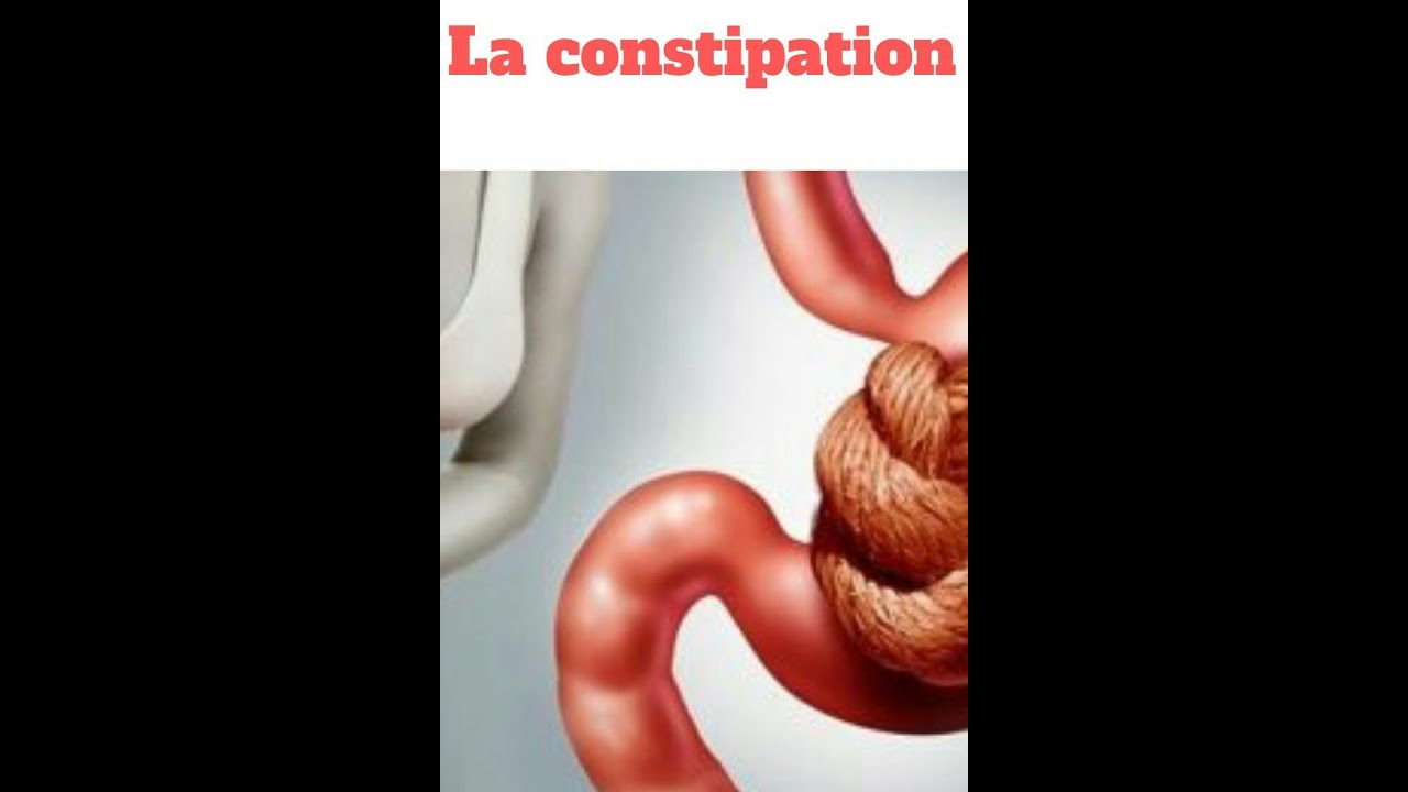 ASTUCE NATUREL PUISSANTE POUR SOIGNER LA CONSTIPATION - YouTube