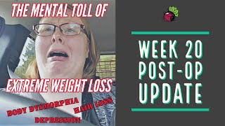 Weight Loss Surgery in Mexico Post-Op Week 20 Update  | My Gastric Bypass Journey