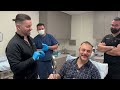 best fue hair transplant in los angeles fue hair restoration in la fue fuehairrestoration hair