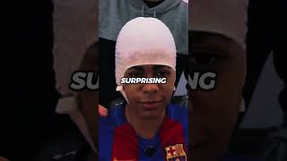 The real reason Lamine Yamal always hides his forehead. 😳😞