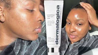 How to Fade Dark Spots in ONLY 5 Days! | Dermalogica PowerBright Dark Spot Peel Review | Kensthetic