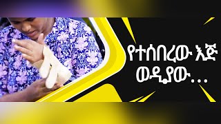 1098 የተሰበረው እጅ ወዲያው… || Prophet Eyu Chufa || Christ Army Tv