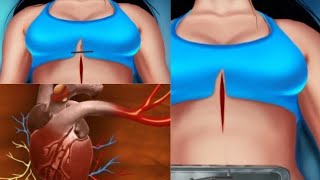 ASMR treatments and serious surgeries animation | ASMR animation video
