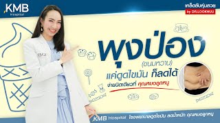 ติดหวานพุงไม่ยอมลง KMB hospital โรงพยาบาลดูดไขมัน ลดน้ำหนัก : คุณหมอลูกหนู