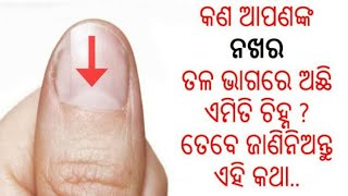 ନଖ ଉପରେ ତିଆରି ଅଧା ଚନ୍ଦ୍ରମା ଖୋଲିଥାଏ ଜୀବନ ସହ ଜଡିତ ବହୁତ କିଛି ରାଜ୍, ଜାଣନ୍ତୁ କଣ ହୋଇଥାଏ ଏହାର ଅର୍ଥ ?