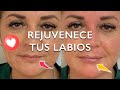 REJUVENCE tu labios 👄 con solo 1ml de Ácido HIALURÓNICO 💉