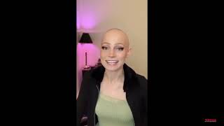 Best Wigs for Alopecia