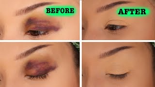 WELL THIS JUST HAPPENED.......HOW TO CORRECT A BLACK EYE/BRUISE WITH MAKEUP