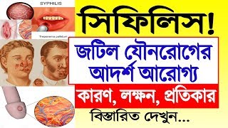 সিফিলিস রোগের লক্ষণ ও প্রতিকার হোমিওপ্যাথিক চিকিৎসা