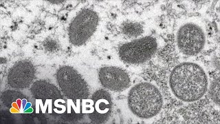 CDC Warns Of Monkeypox. Here’s How It Spreads.