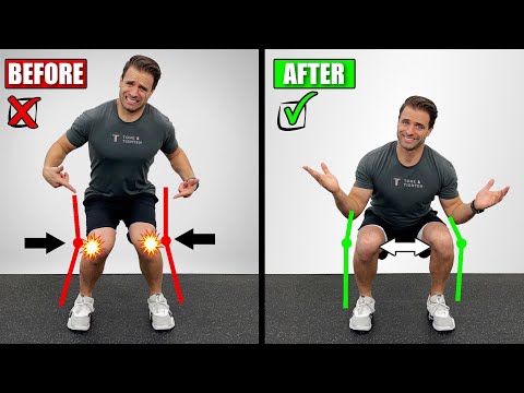 How To Fix Knock Knees (Exercises To Correct Knee Valgus)