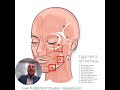 Facial Ligaments Dissection in #deepplanefacelift |  Dr. Raghu Athre, MD FACS