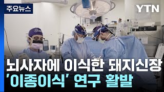 [과학 한스푼] 뇌사자 몸에서 살아 기능하는 돼지 신장...'이종이식' 어디까지 왔나? / YTN