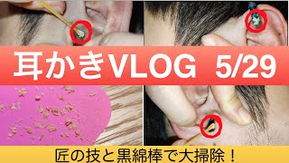 耳かきVLOG（旦那の汚耳を大掃除）