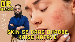 Skin Se DAAG DHABBE Kaise Hataye | How to Remove Blackheads, Scars \u0026 Blemishes | Dr. M. Ibrahim