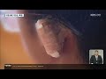 지적장애인 감금에 폭행까지…경찰 초기 대응 미적 kbs 2022.10.13.