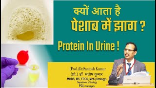 Protein in Urine. पेशाब में प्रोटीन.(Prof)Santosh Kumar PGI