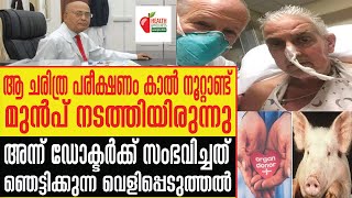 Heart Transplant  പന്നിയുടെ ഹൃദയം മനുഷ്യനില്‍ പരീക്ഷണം കാല്‍ നൂറ്റാണ്ട് മുന്‍പും