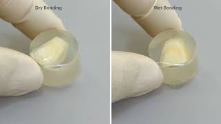 IVOCLAR - Adhese Universal Wet Bonding vs Dry Bonding