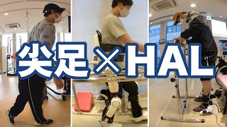 HALによるアプローチ：脳性麻痺の方の 尖足（つま先歩行）