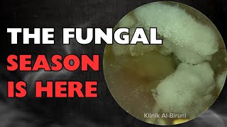 The FUNGAL SEASON Is Here😱