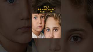 가지고 잇기 어려운 희귀한 신체특징 TOP 7