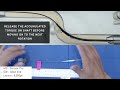 a quick tutorial on advancing your microcatheter through the lesion.