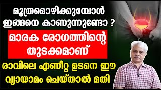 മൂത്രമൊഴിക്കുമ്പോൾ ഇങ്ങനെ കാണുന്നുണ്ടോ മാരക രോഗത്തിന്റെ തുടക്കമാണ്