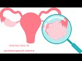 Ovarian Cysts in Postmenopausal Women