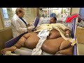 10 Most Overweight People in the World