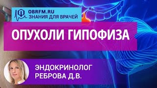 Эндокринолог Реброва Д.В.: Опухоли гипофиза