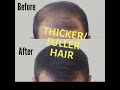 THICK FIBER l Hair Building Fibers I Hair Loss Concealer I Instant thinning Hair solution!