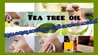 Tea tree essential oil benefits //മുഖക്കുരു മായ്ക്കും ടീ ട്രീ ഓയില്‍ മാജിക്//sapz life