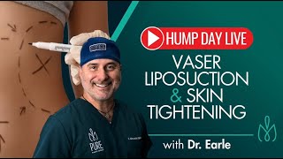 Hump Day Live: VASER Liposuction & Skin Tightening episode with Dr. Earle 👇