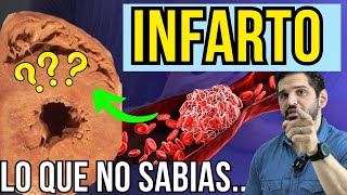 ¡Descúbrelo! INFARTO vs ISQUEMIA del corazón ¿Es lo mismo? 🤨