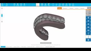 designing a full mouth smille