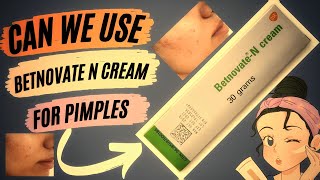 how can we use  betnovate n cream for pimples|| how to use betnovate n cream betnovate n skin cream