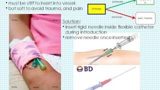 TRIZ - Separation Principles and Innovation Workbench