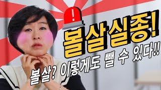 볼살실종? 볼살! 이렇게도 뺄 수 있습니다!!! (볼살 빼는 운동 모음)