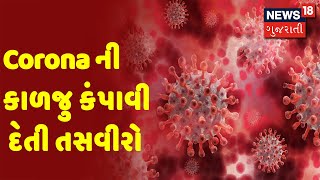 Corona ની કાળજુ કંપાવી દેતી તસવીરો | Special Report | News18 Gujarati